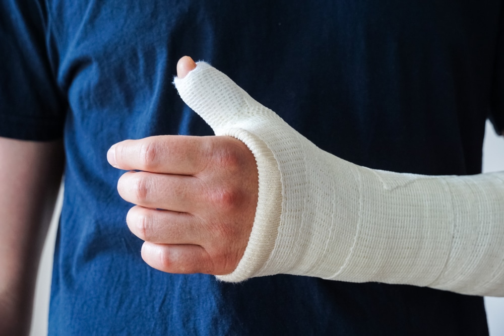 Man's hand and arm in a cast